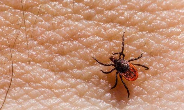 First Congo fever death of the year reported in Sindh