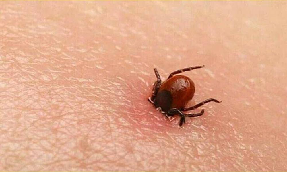 Two more Congo virus cases reported in KP, number rises to 9