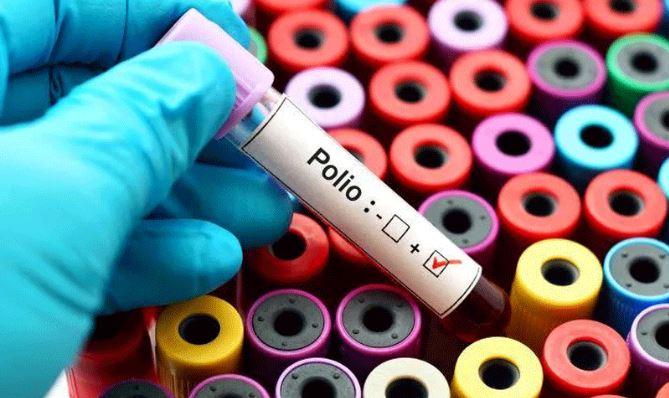 ملک بھر سے حاصل کردہ  102 ماحولیاتی نمونوں سے 30 میں پولیو وائرس کی  تصدیق