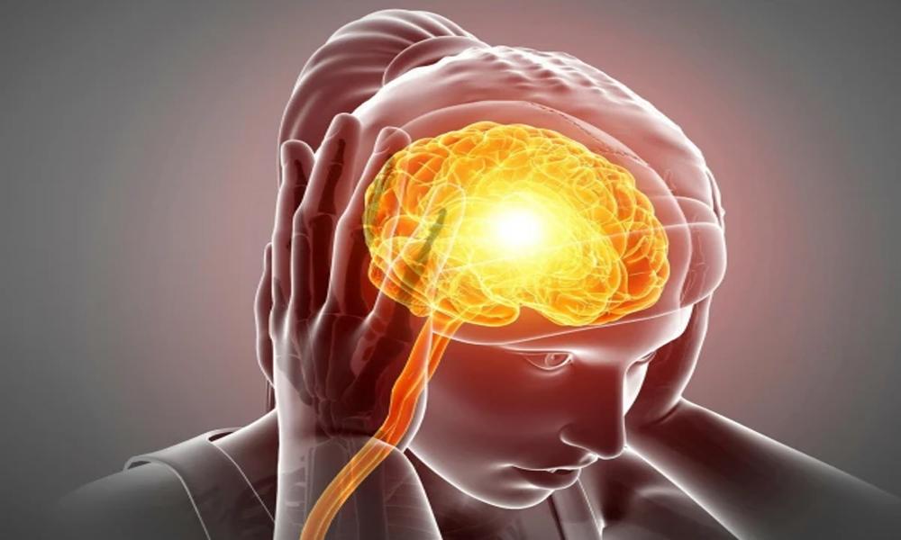 Climate change may cause migraines, experts say