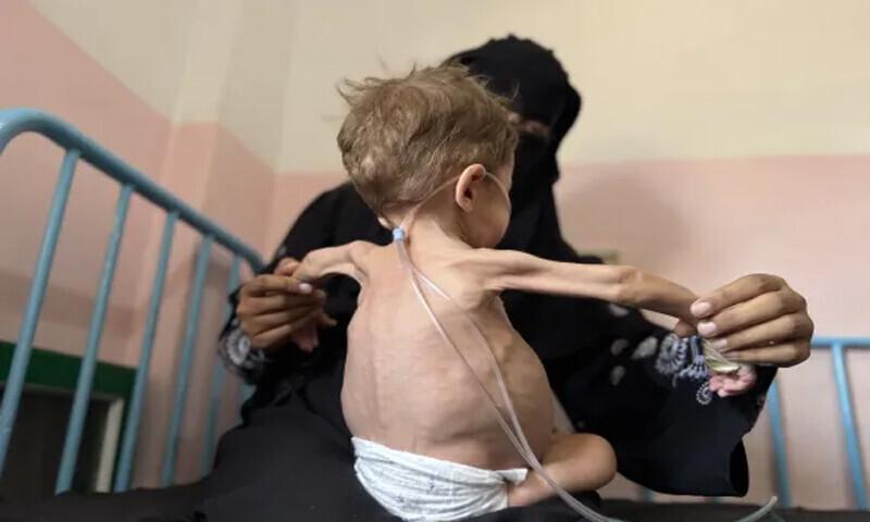 اقوام متحدہ نے غزہ کو قحط زدہ قرار دے دیا