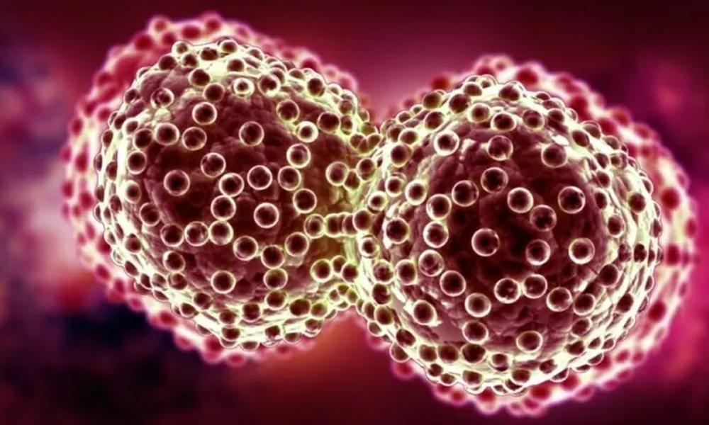Govt to establish national cancer registry