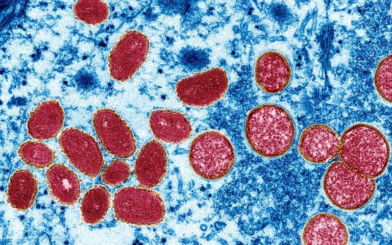 لاہور میں  منکی پاکس کا خطرہ سنگین ہوگیا،مزید دو نئے کیسز سامنے آ گئے