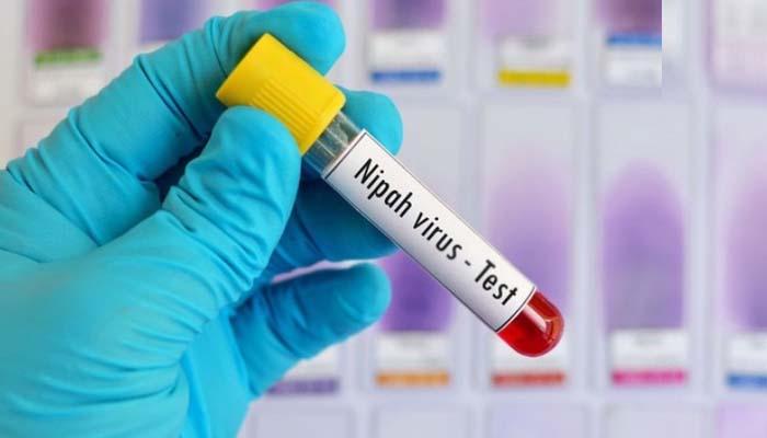 قومی ادارہ صحت نے نیپاہ وائرس کی ٹیسٹنگ کٹس حاصل کرلیں