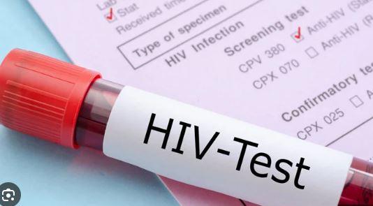 Islamabad records 618 new HIV cases