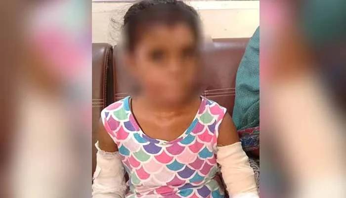Stepfather sets eight-year-old on fire using petrol in Karachi