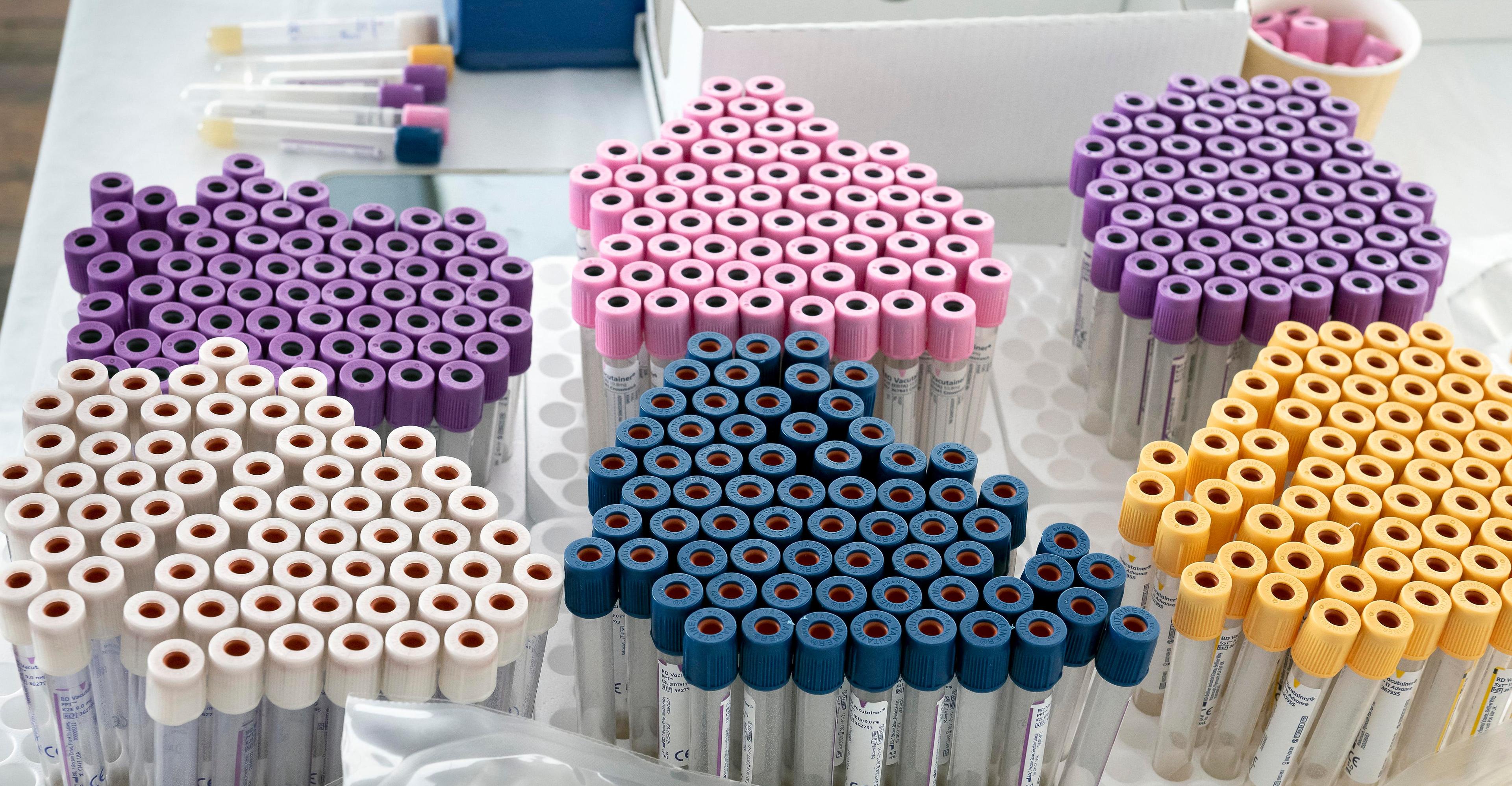 The liver transplant system tried to fix its sex bias. Did it work?