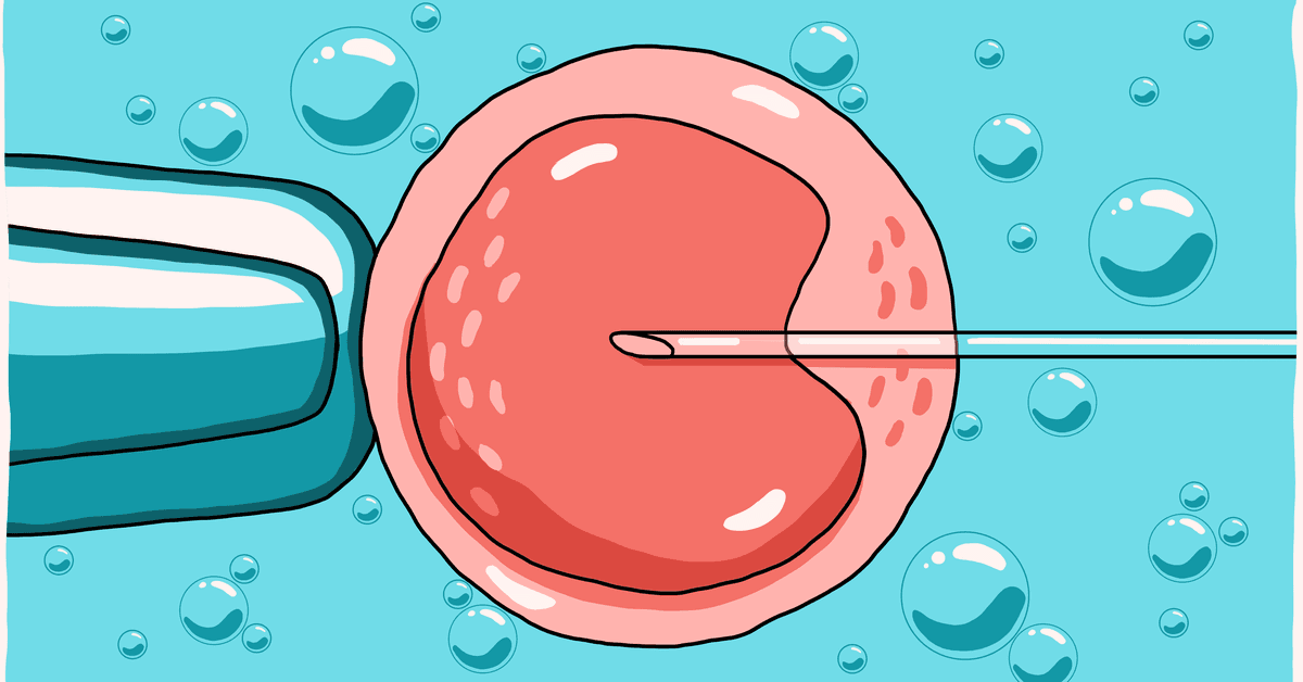 An illustrated guide to IVF