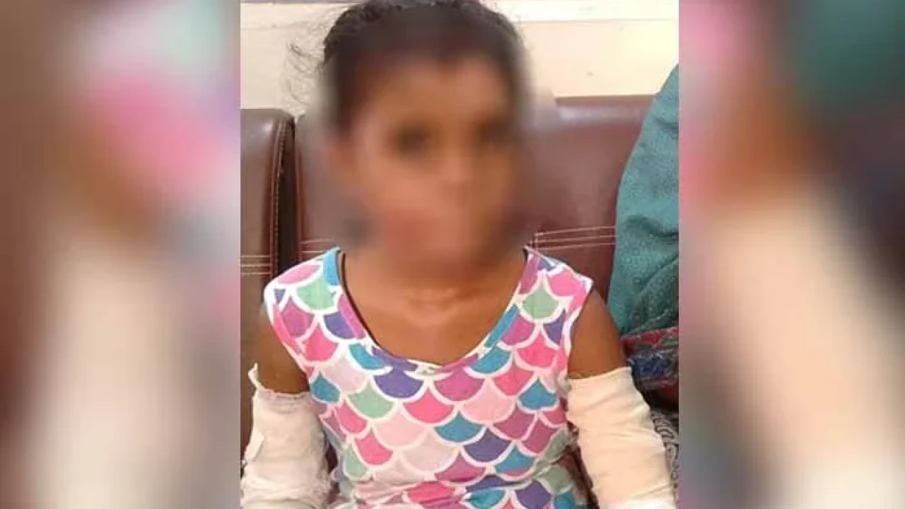 Stepfather sets eight-year-old on fire using petrol in Karachi